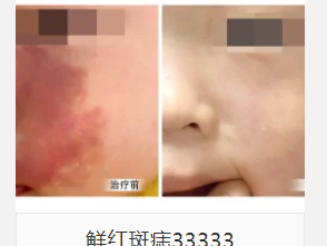 壹加壹各分院特色項(xiàng)目大盤(pán)點(diǎn)