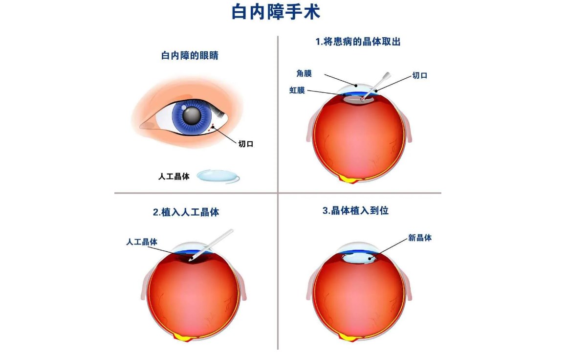 友華普惠眼科與其他醫(yī)院對比:優(yōu)勢凸顯