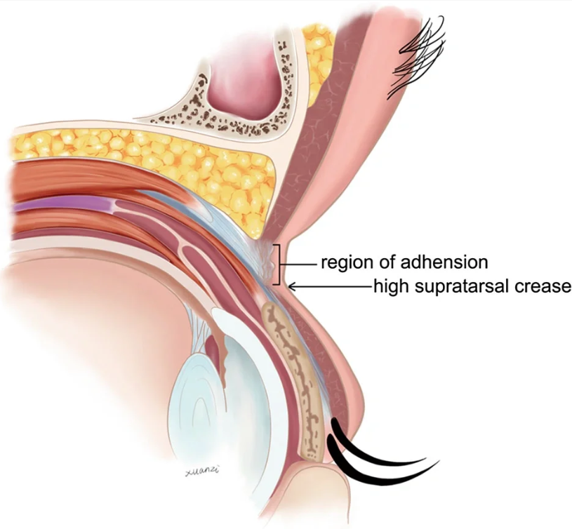 上海九院雙眼皮王牌專家——朱惠敏、蘇薇潔等領(lǐng)銜，技術(shù)口碑雙優(yōu)值得信賴！ 