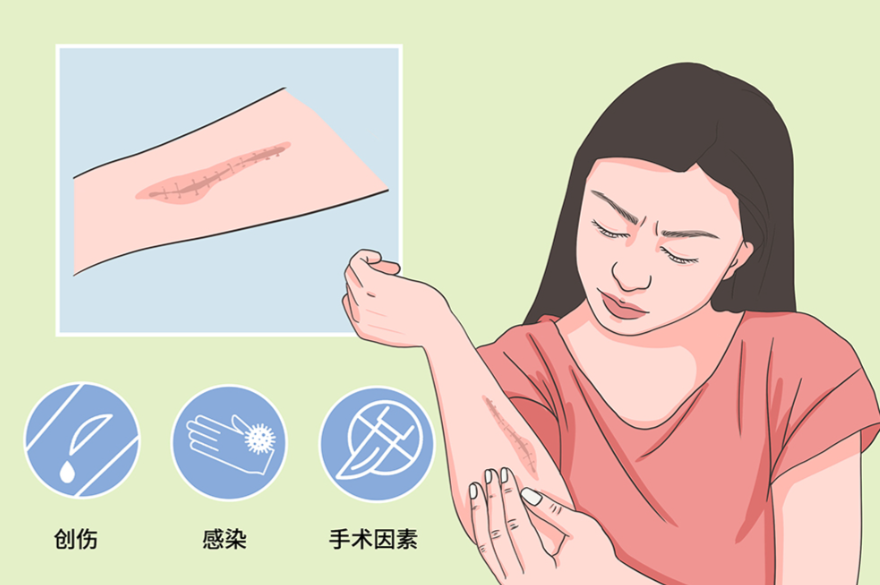 如何選擇適合自己的哈爾濱祛疤醫(yī)院