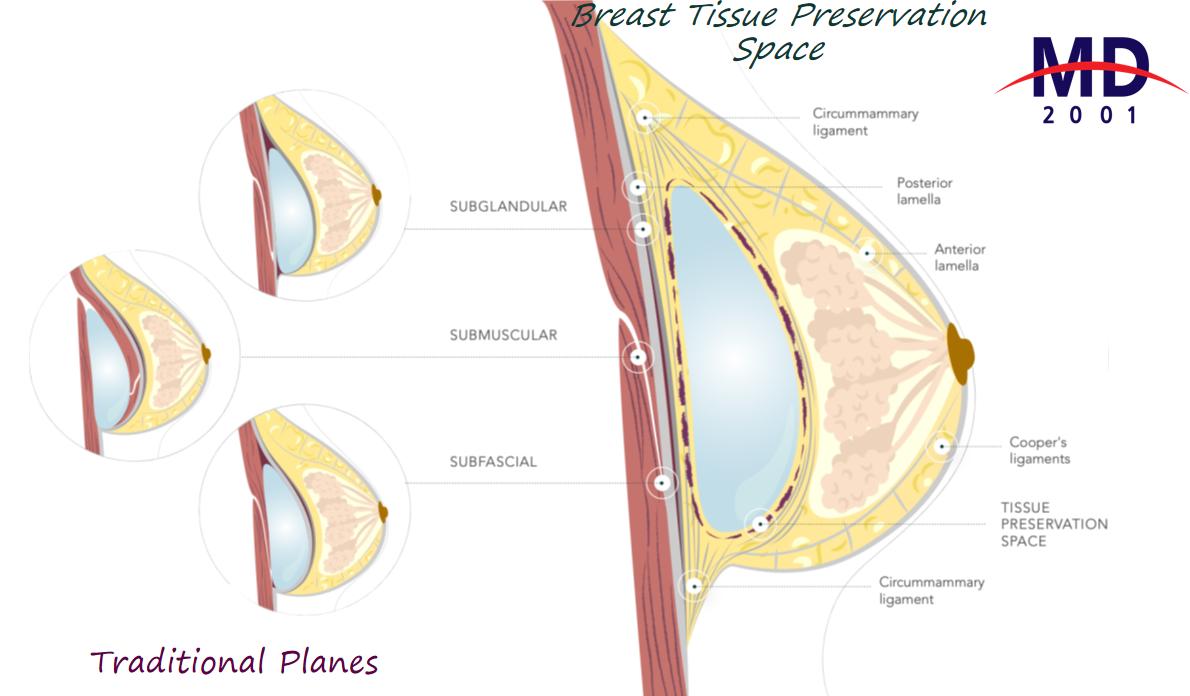 天津小胸治療價格全解析