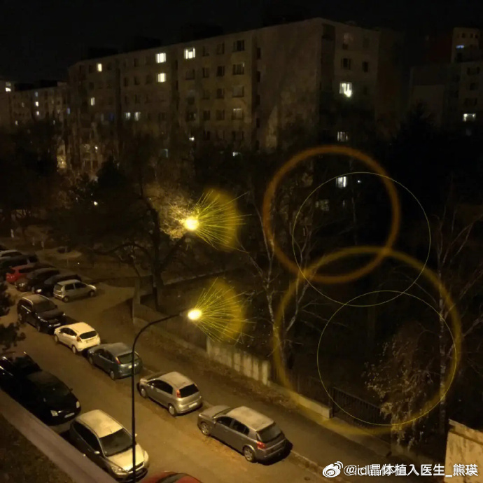 選擇友華普惠眼科的注意事項:避坑指南