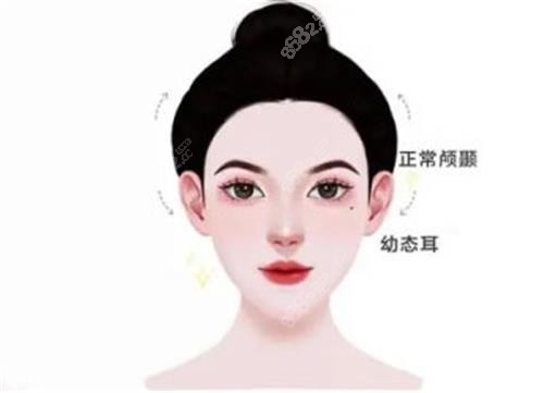 幼態(tài)臉的示意圖 幼態(tài)臉的示意圖