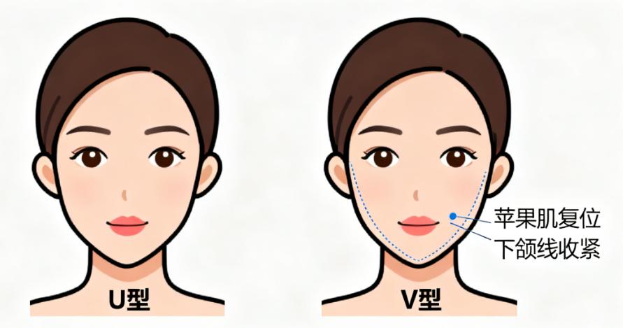 北京做中下面大拉皮