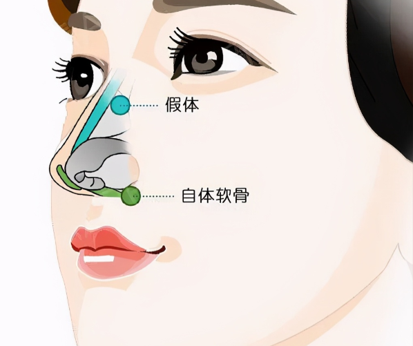 如何选择适合自己的医生