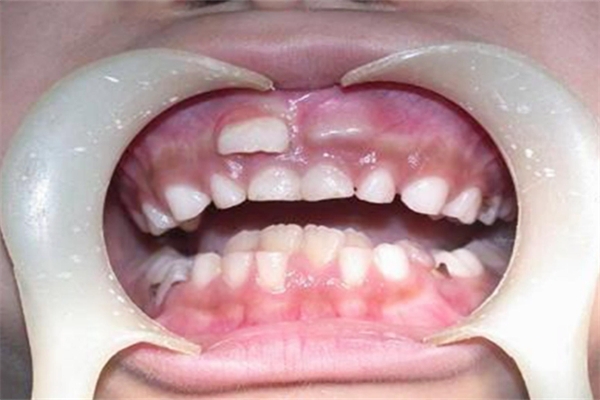 合肥仁德口腔医院儿童科怎么样？医疗团队好环境佳价格合理口碑还不错