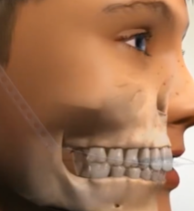 牙齿矫正周博士怎么样？患者评价、专业水平与服务体验深度解析