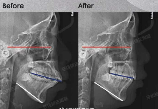 牙齿矫正周博士