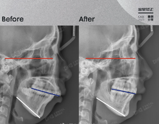 牙齿矫正周博士