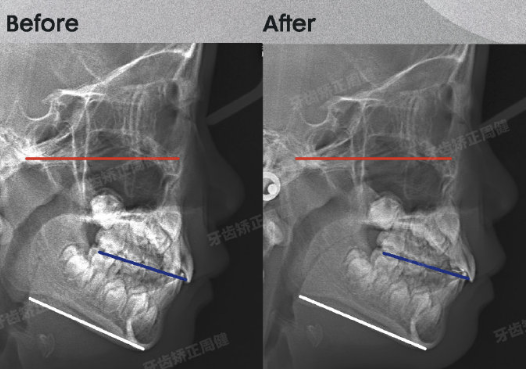 牙齿矫正周博士