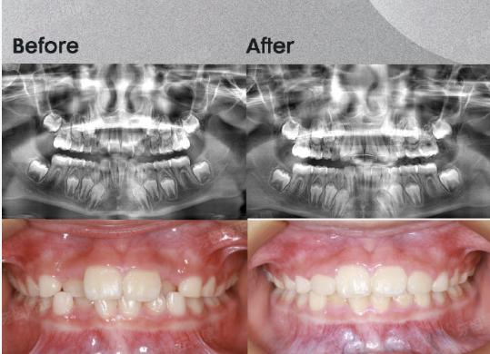牙齿矫正周博士