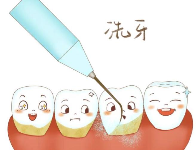 平谷区医院能洗牙吗？希美口腔洗牙价格透明，专业团队+进口设备，在线预约免排队！