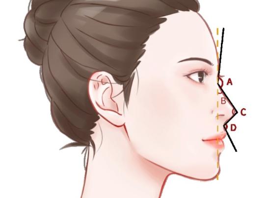 郑州鼻整形 “自然派” 代表张海洋：鼻型耐看 10 年，靠的是结构支撑而非模板