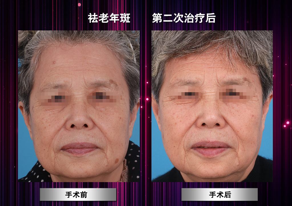 西安交通大学第二附属医院皮肤科就诊指引