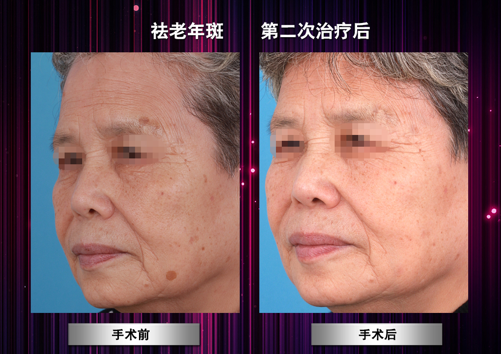 皮肤科医生推荐：任医生看诊体验