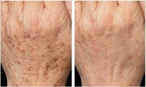 热门治疗项目：祛痘/光子嫩肤/过敏调理