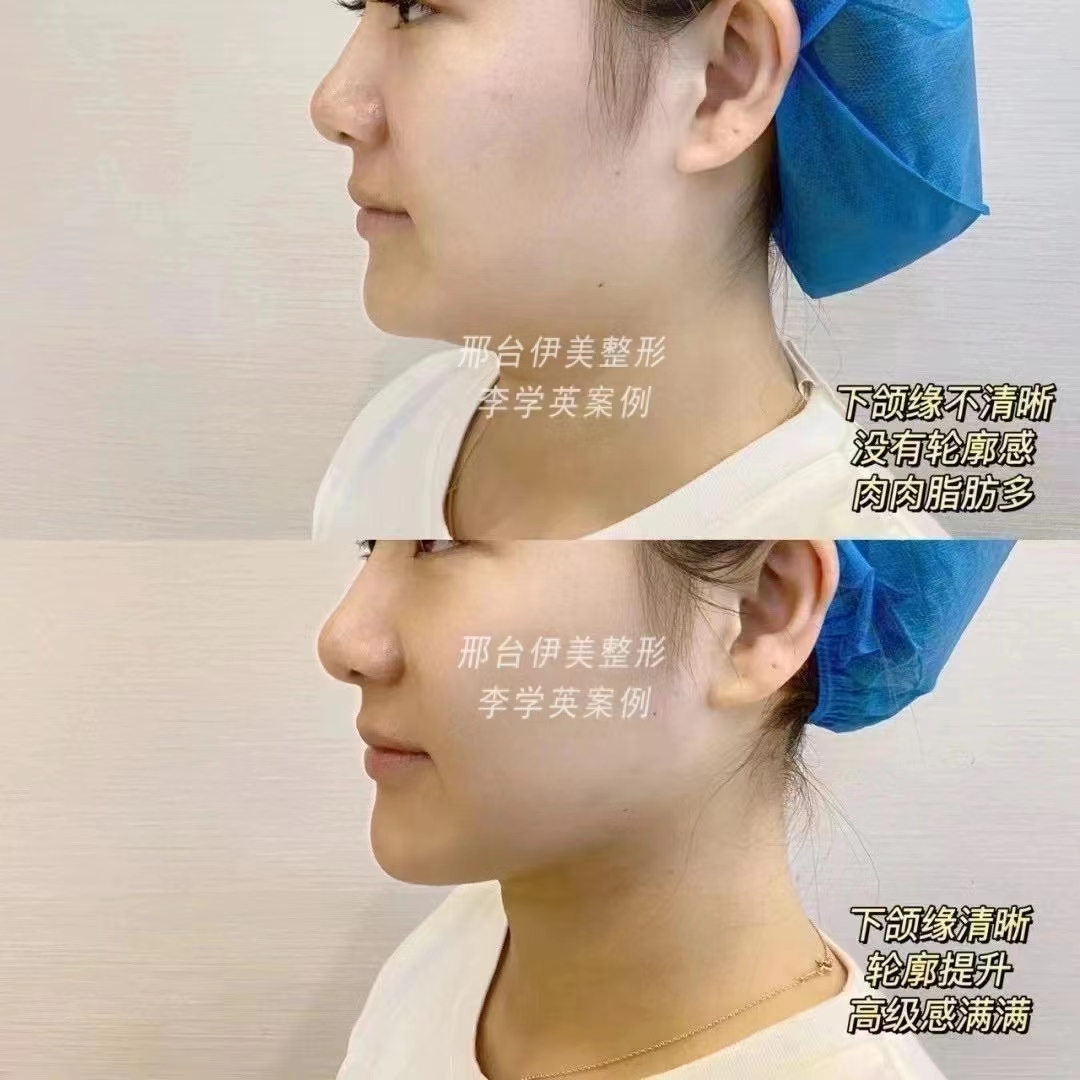 挂号建议与避坑指南