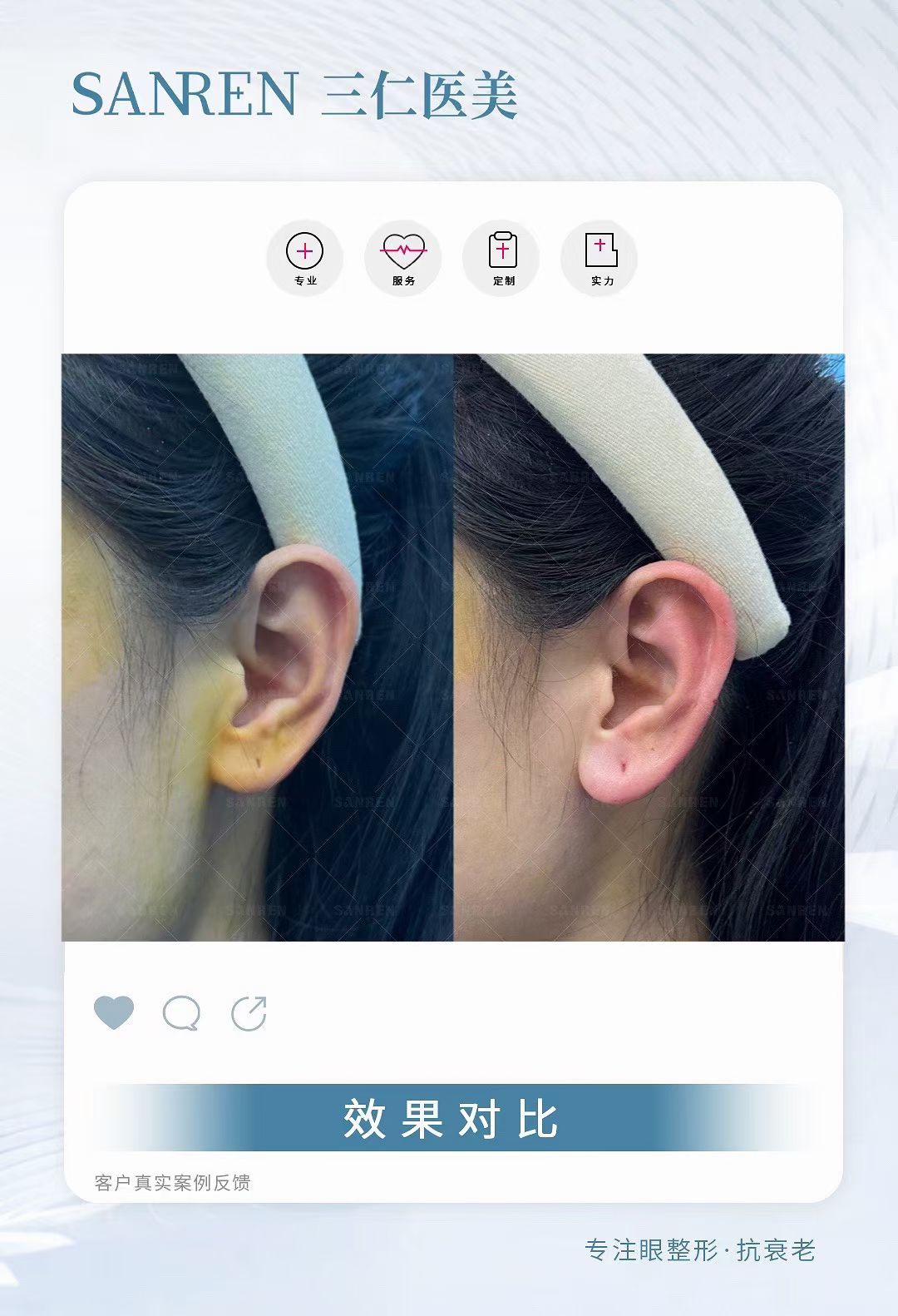 北京做保留粘膜全段緊縮術(shù)去哪好？北京嘉禾醫(yī)院技術(shù)優(yōu)價(jià)格還實(shí)在！www.66ub.cn