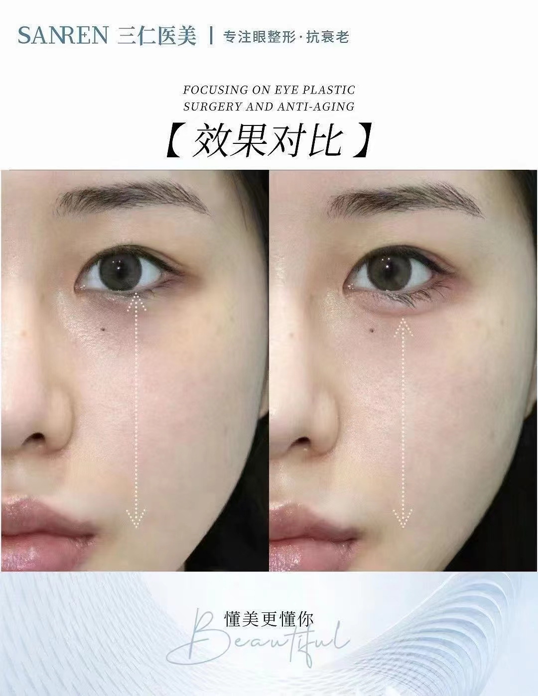 北京做保留粘膜全段緊縮術(shù)去哪好？北京新星靚醫(yī)療美容技術(shù)優(yōu)價(jià)格還實(shí)在！