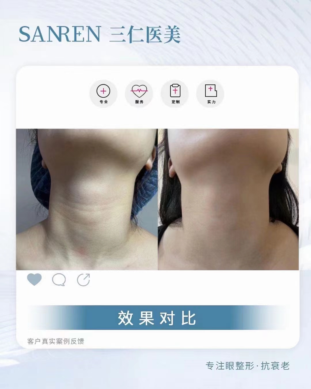 北京做保留粘膜全段緊縮術(shù)去哪好？北京雅宸醫(yī)療美容技術(shù)優(yōu)價(jià)格還實(shí)在！