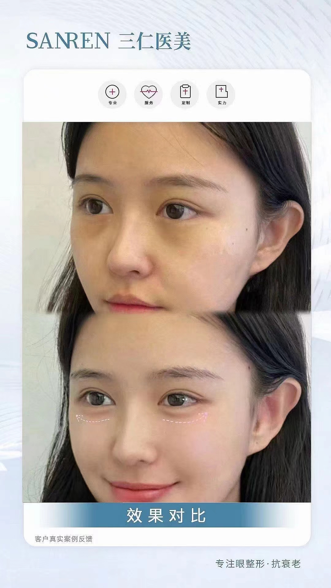 北京做保留粘膜全段緊縮術(shù)去哪好？北京四季青橙技術(shù)優(yōu)價(jià)格還實(shí)在！