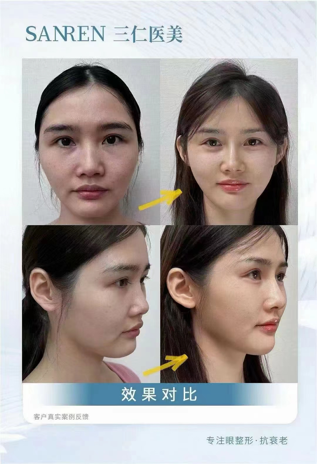 北京做保留粘膜全段緊縮術(shù)去哪好？北京京城皮膚醫(yī)院技術(shù)優(yōu)價(jià)格還實(shí)在！