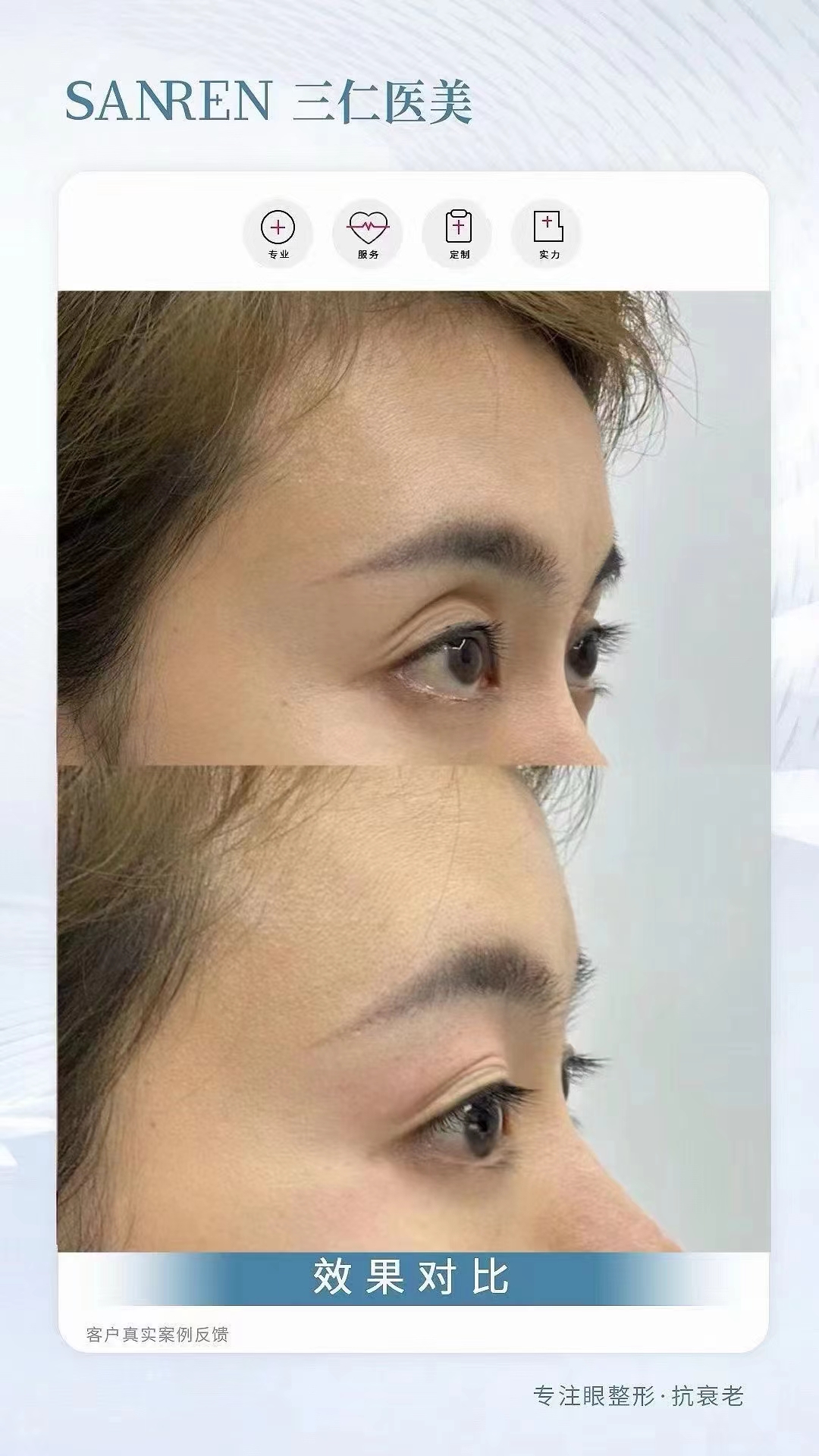 北京做保留粘膜全段緊縮術(shù)去哪好？北京華韓整形技術(shù)優(yōu)價(jià)格還實(shí)在！