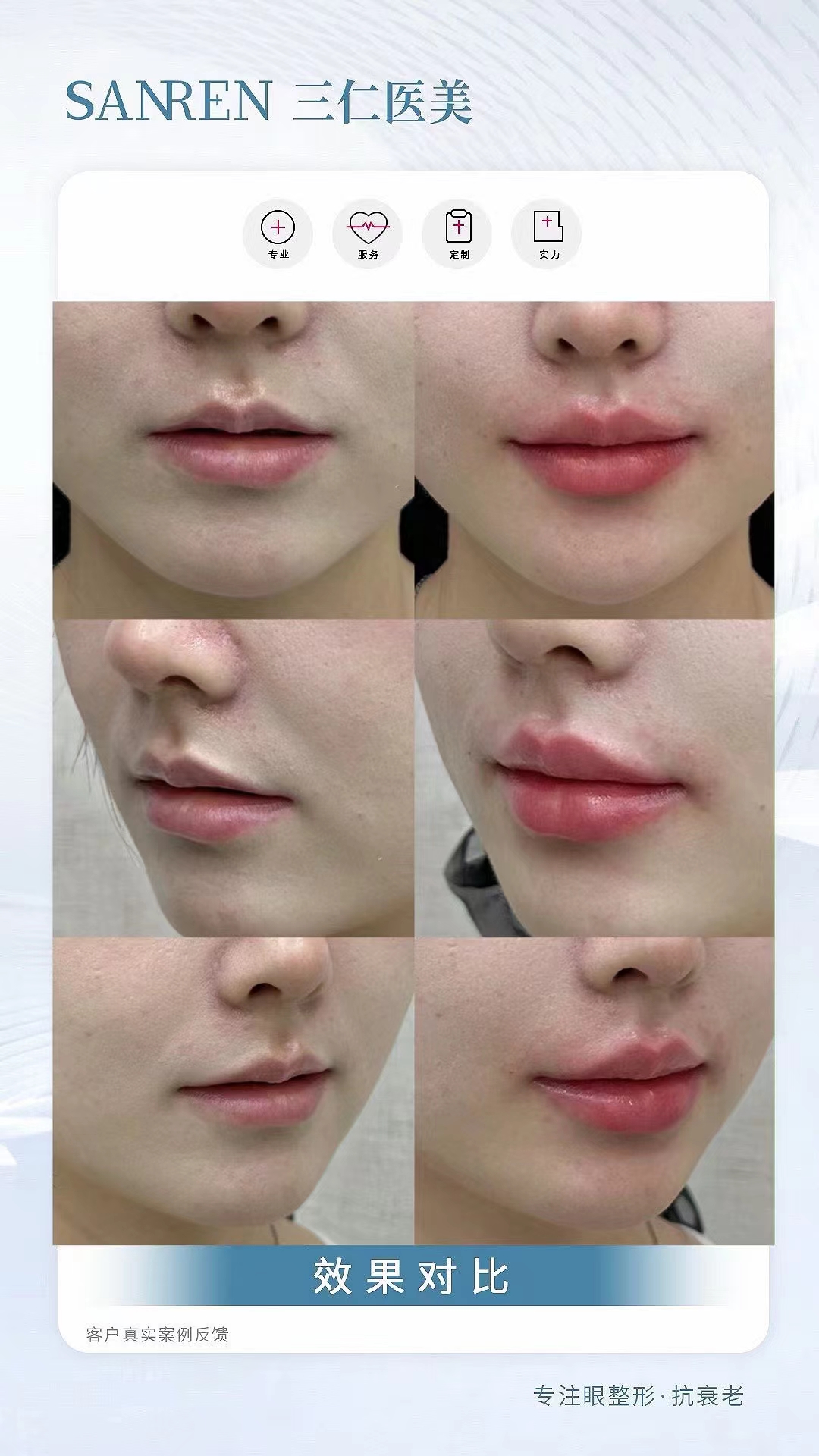 北京做保留粘膜全段緊縮術(shù)去哪好？北京畫美醫(yī)院技術(shù)優(yōu)價(jià)格還實(shí)在！