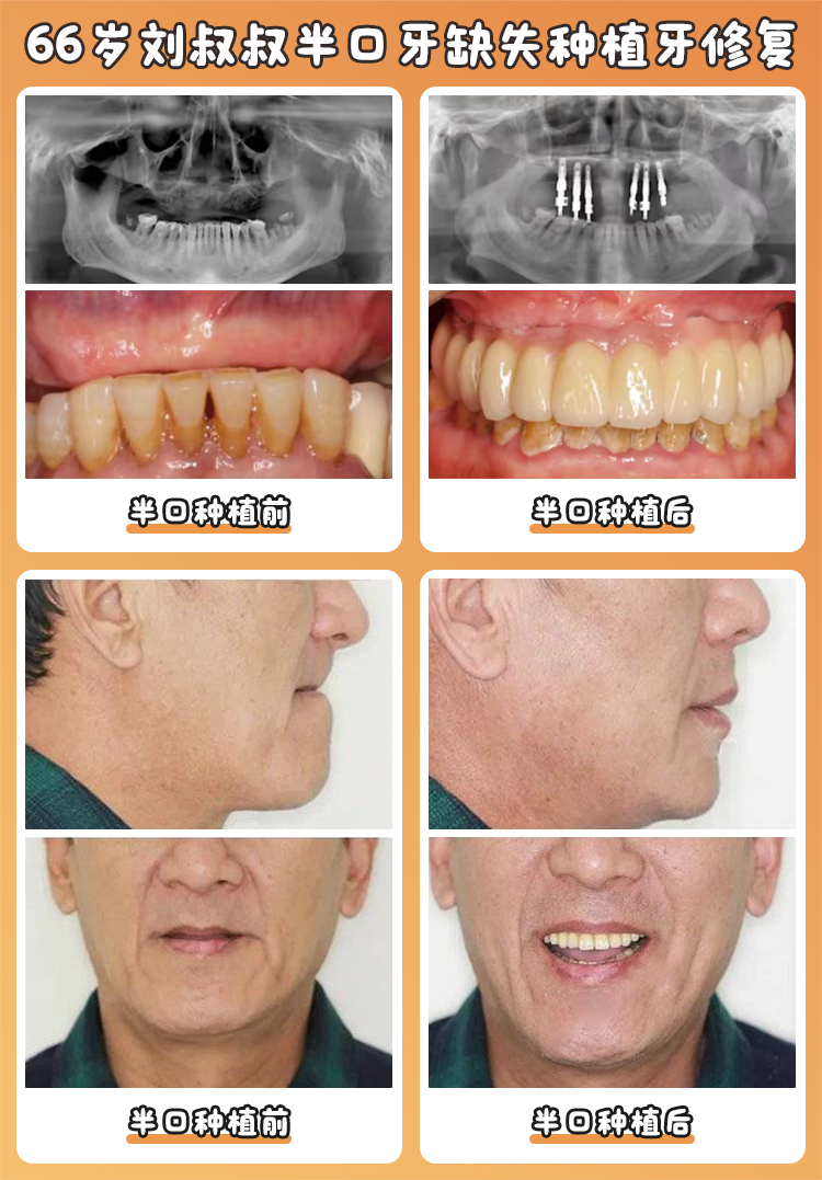 畢節(jié)盛華口腔適合人群——滿足多樣需求