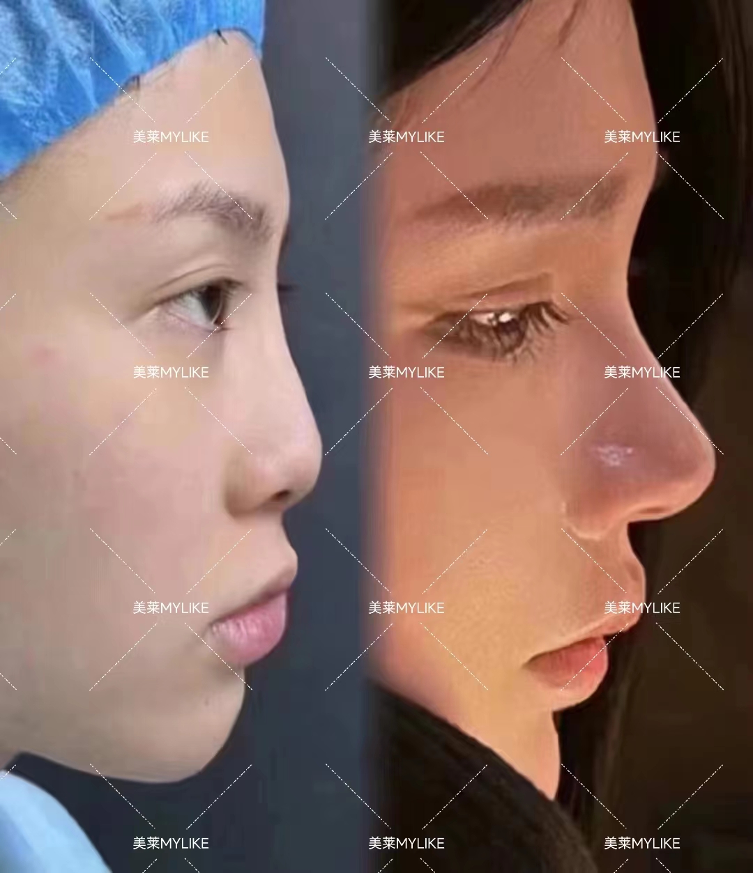 南寧十大美容整形醫(yī)院排名，華美/愛(ài)思特/韓美上榜，隆胸鼻綜合價(jià)格表曝光