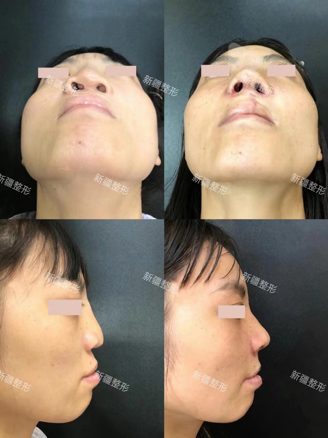 南寧十大美容整形醫(yī)院排名——廣西 南寧愛思特整形醫(yī)院