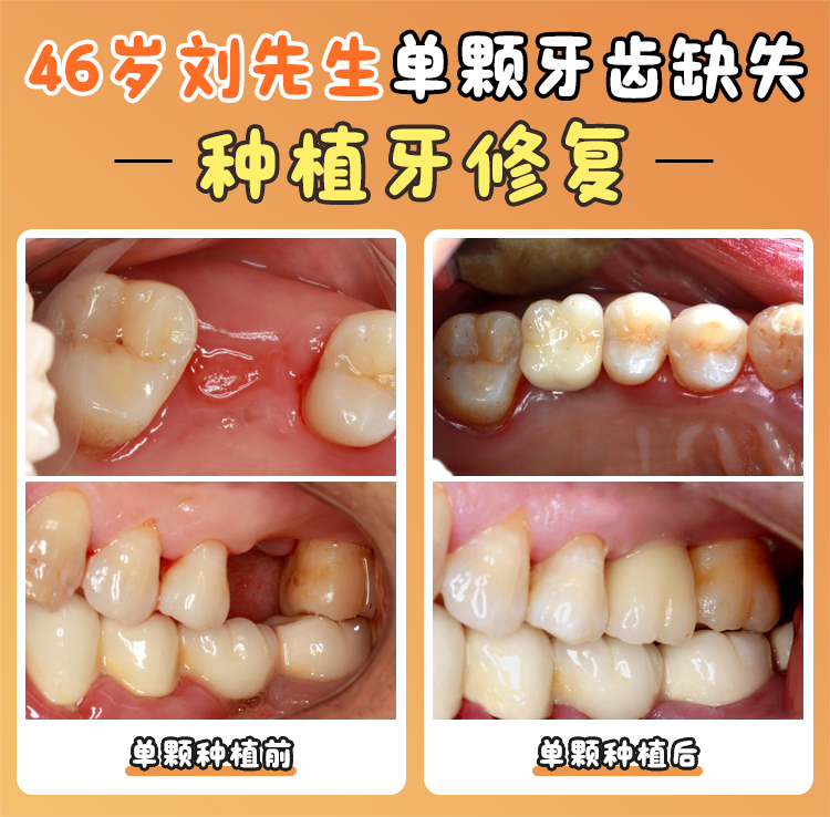 卡爾斯種植體研發(fā)團(tuán)隊(duì)優(yōu)勢(shì)——宿玉成團(tuán)隊(duì)