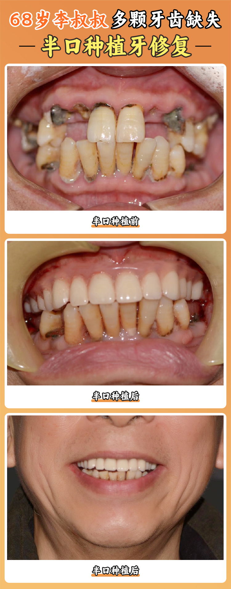 長(zhǎng)治牙博士口腔的資質(zhì)與價(jià)格