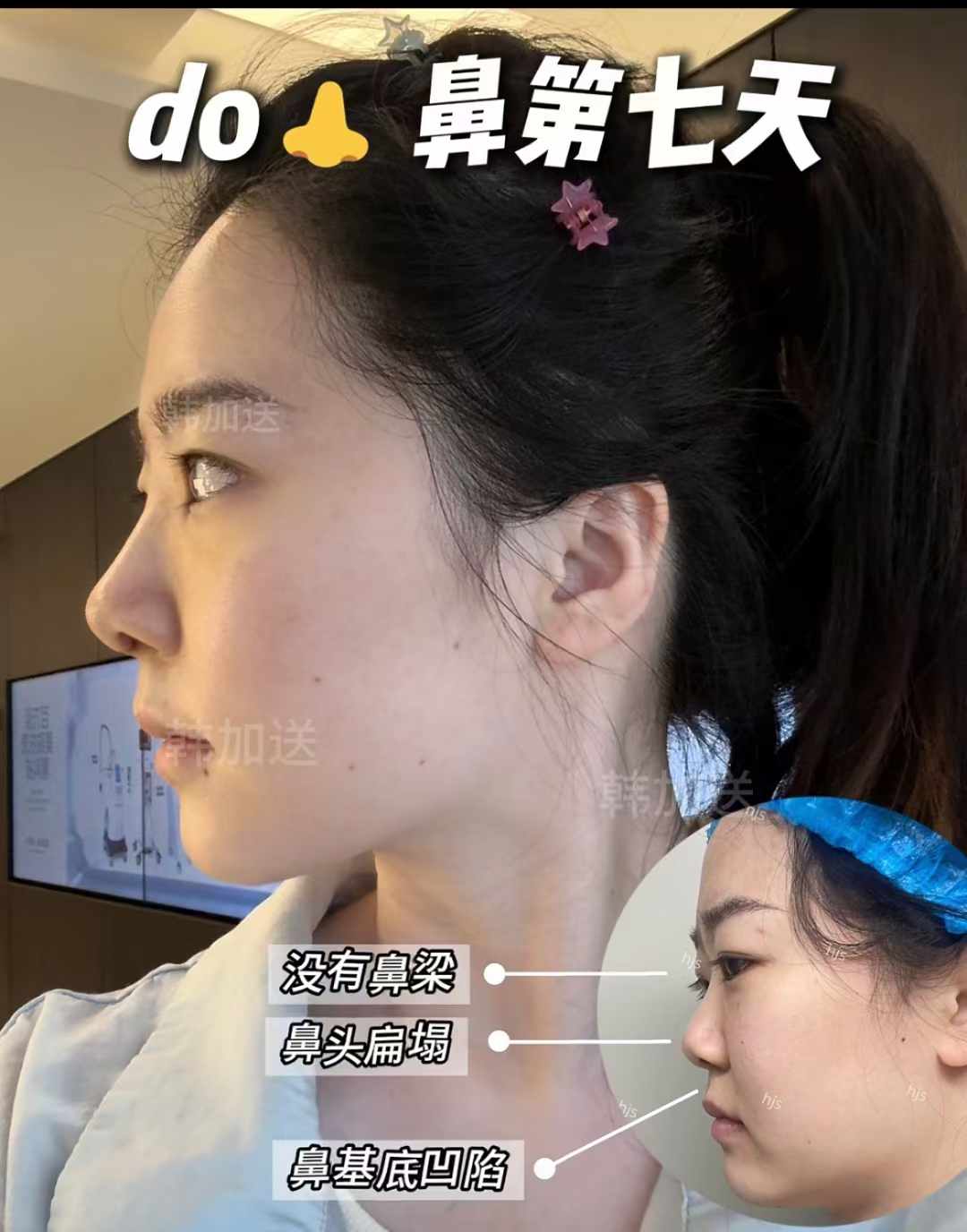 鄭州張海洋醫(yī)生出名嗎？醫(yī)生實力+口碑分析