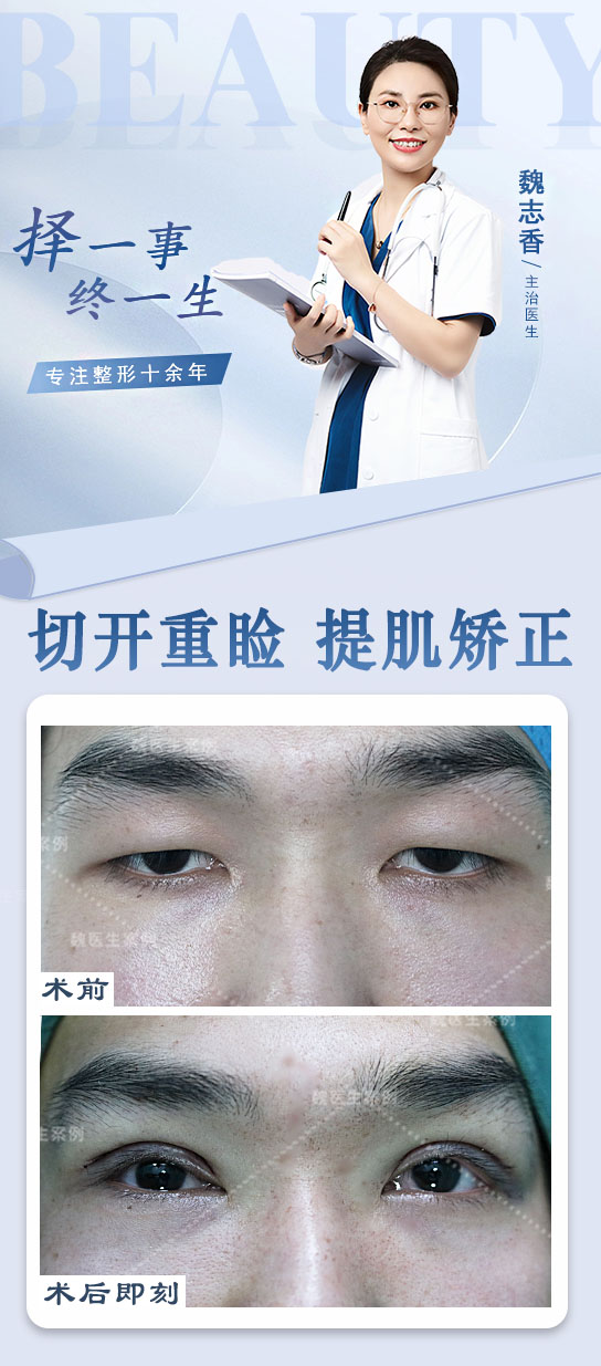 術后修復周期+體驗感揭秘：張海洋醫(yī)生方案更貼近生活節(jié)奏www.66ub.cn