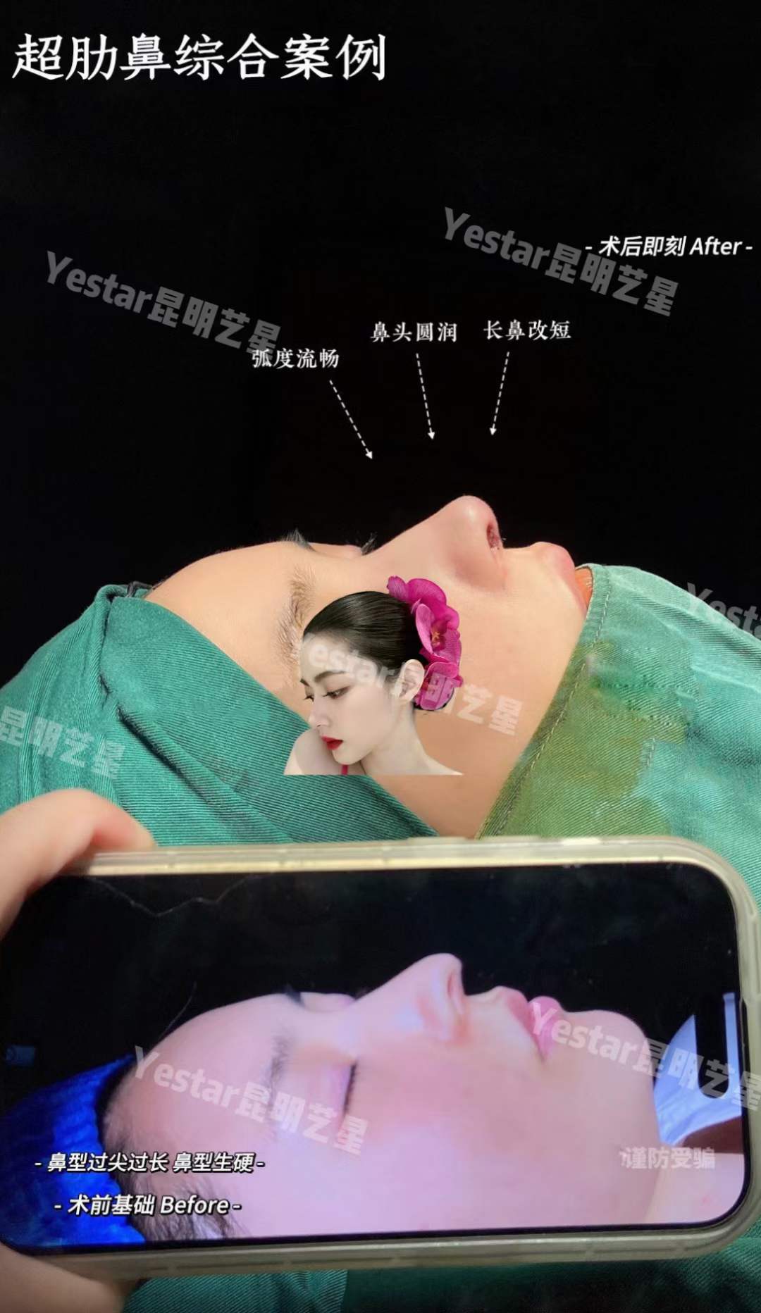 鄭州整形市場競爭激烈，張海洋醫(yī)生如何脫穎而出？