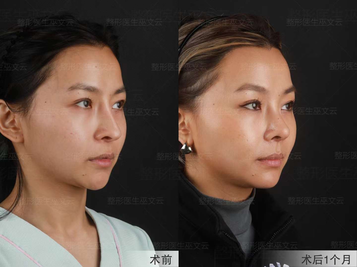 李海濤醫(yī)生的典型實(shí)例展示（簡(jiǎn)要描述）www.66ub.cn