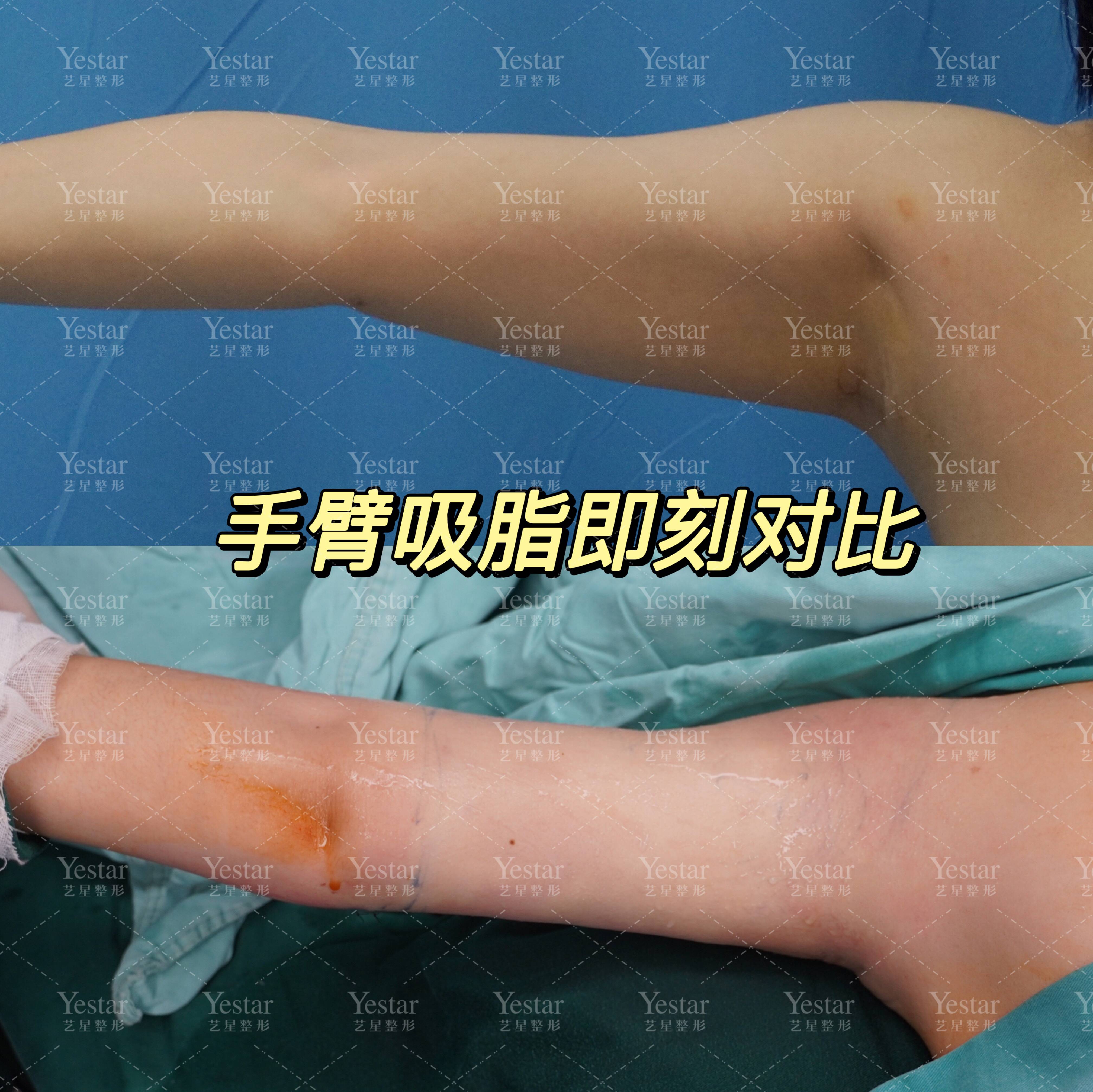 四、深圳福雅整形醫(yī)院患者反饋