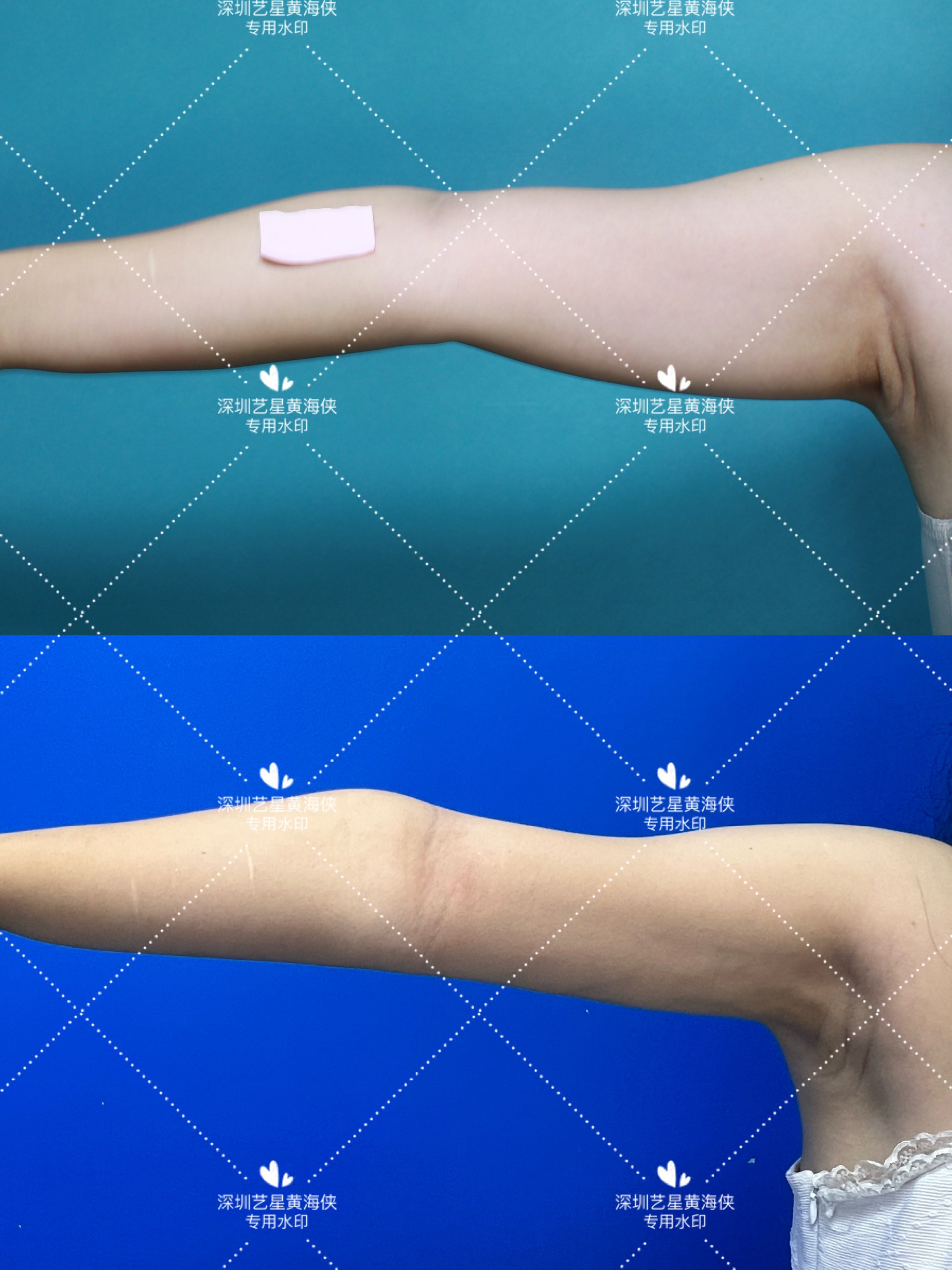 六、深圳福雅整形醫(yī)院正規(guī)靠譜性