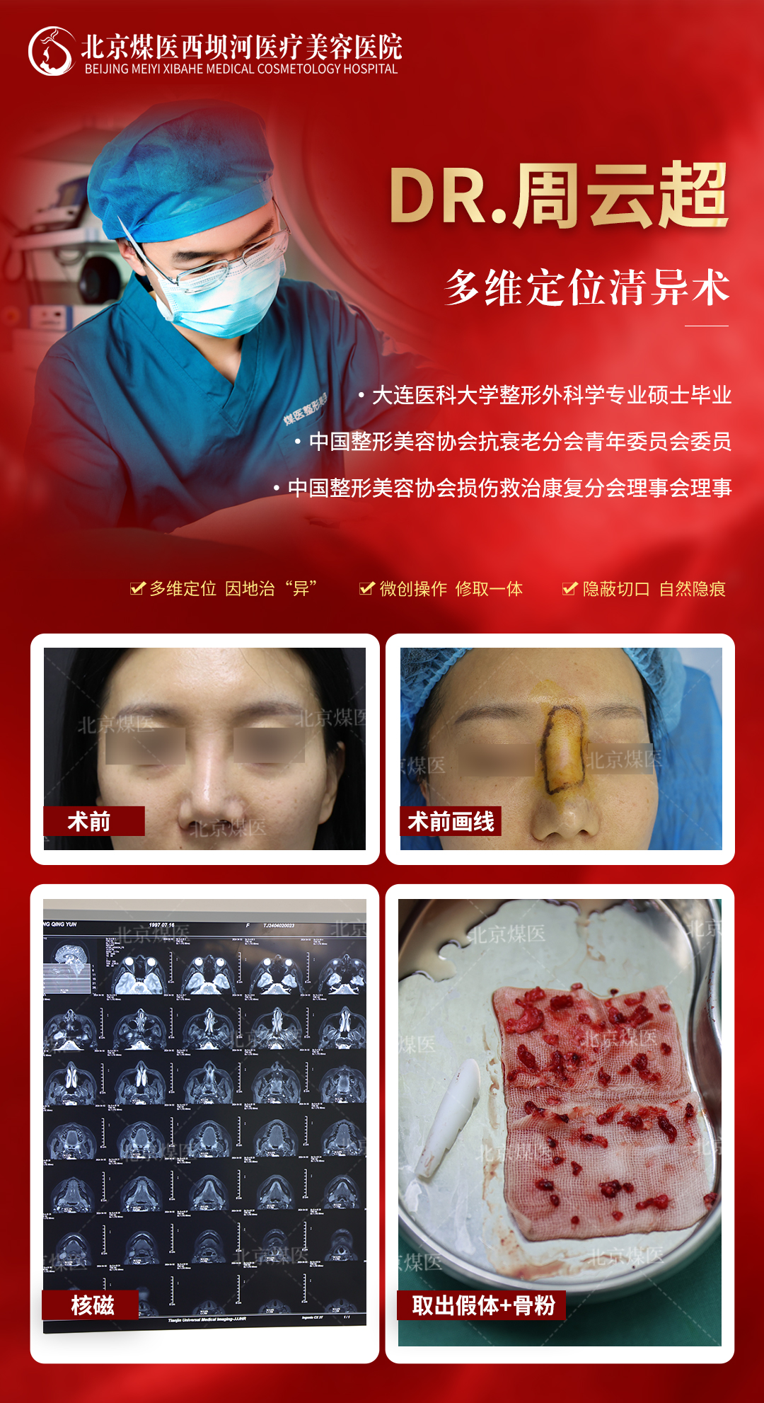 輕醫(yī)美服務(wù)對比