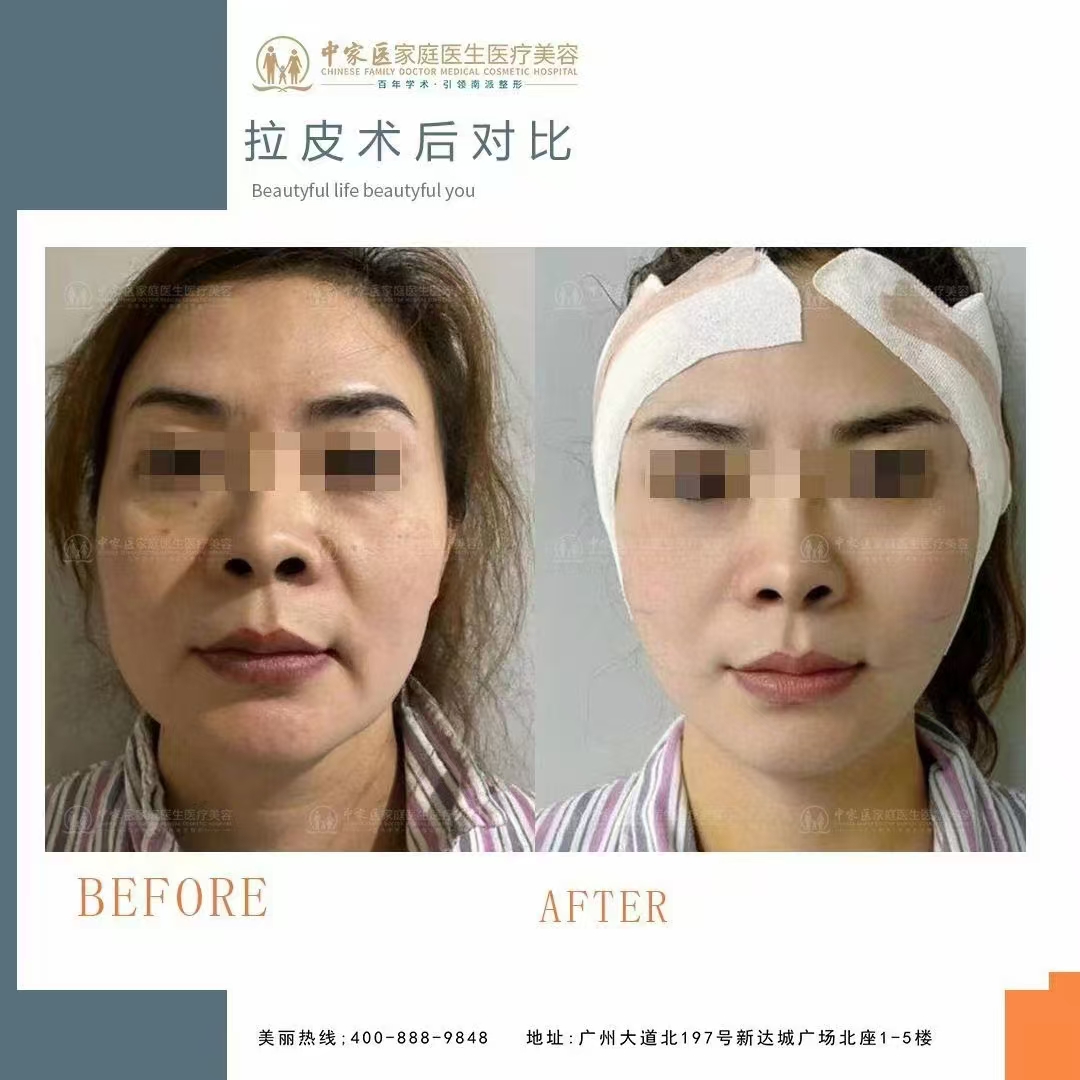 预约前需要做哪些准备工作？