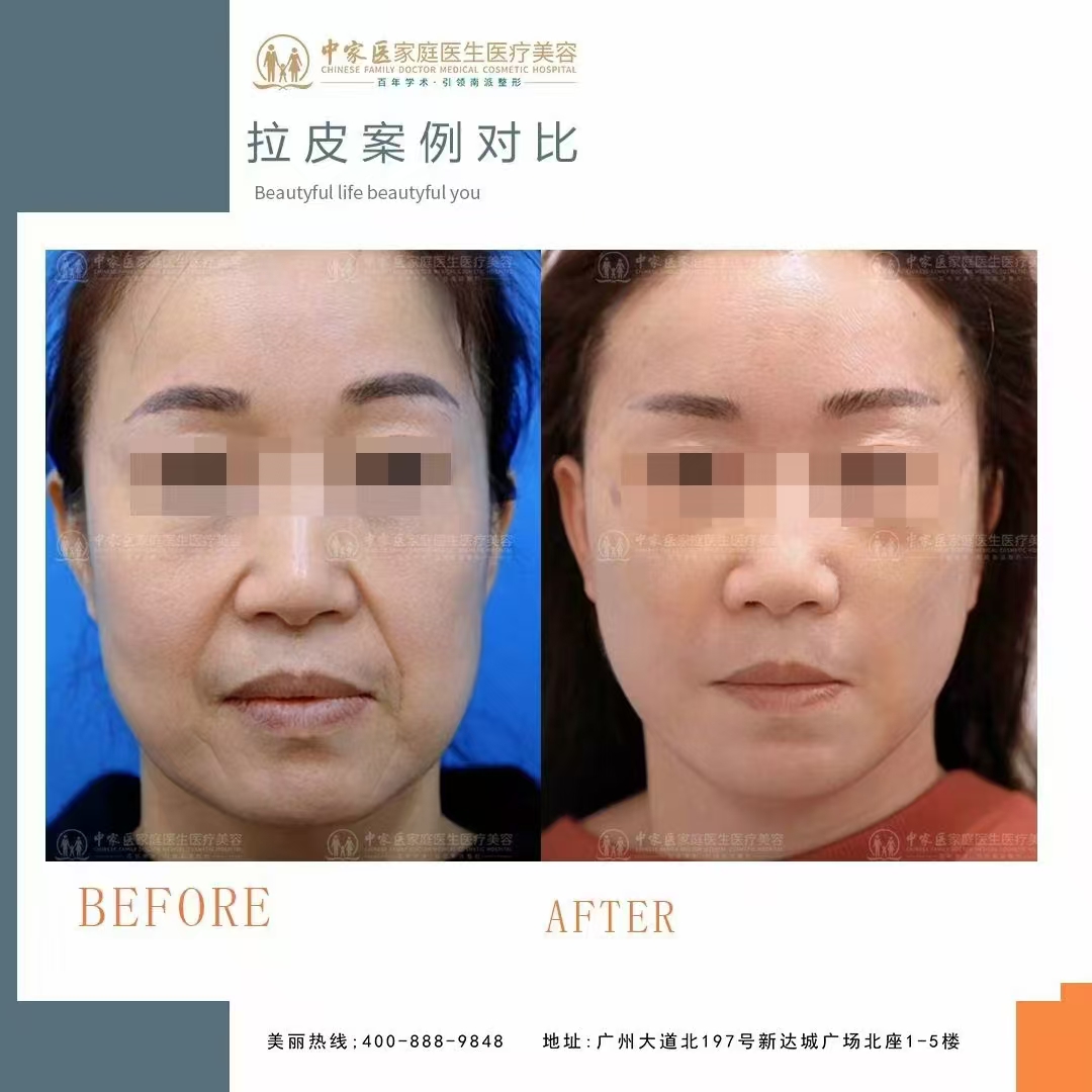 预约过程中需要注意什么？