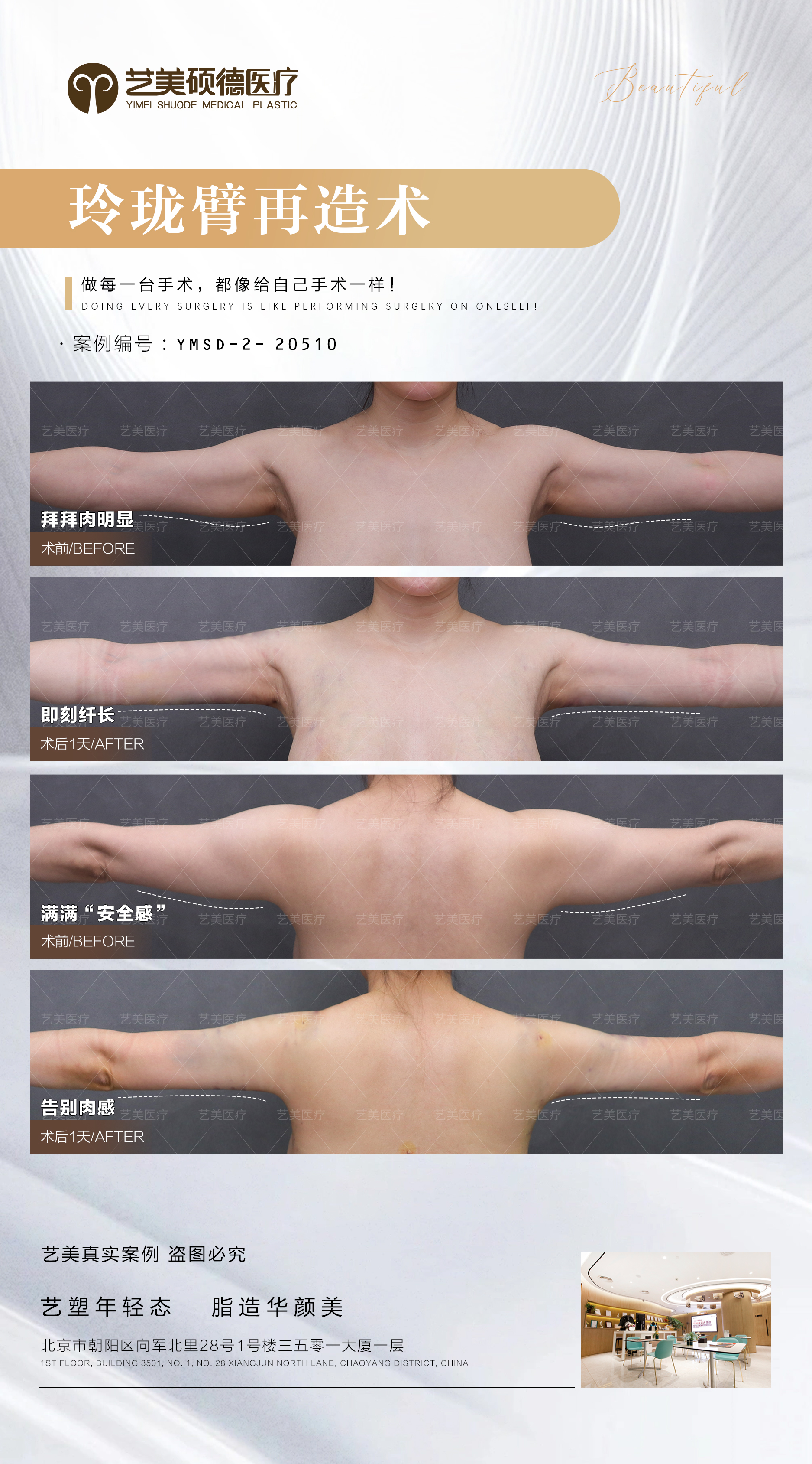 拉皮手术后如何护理?