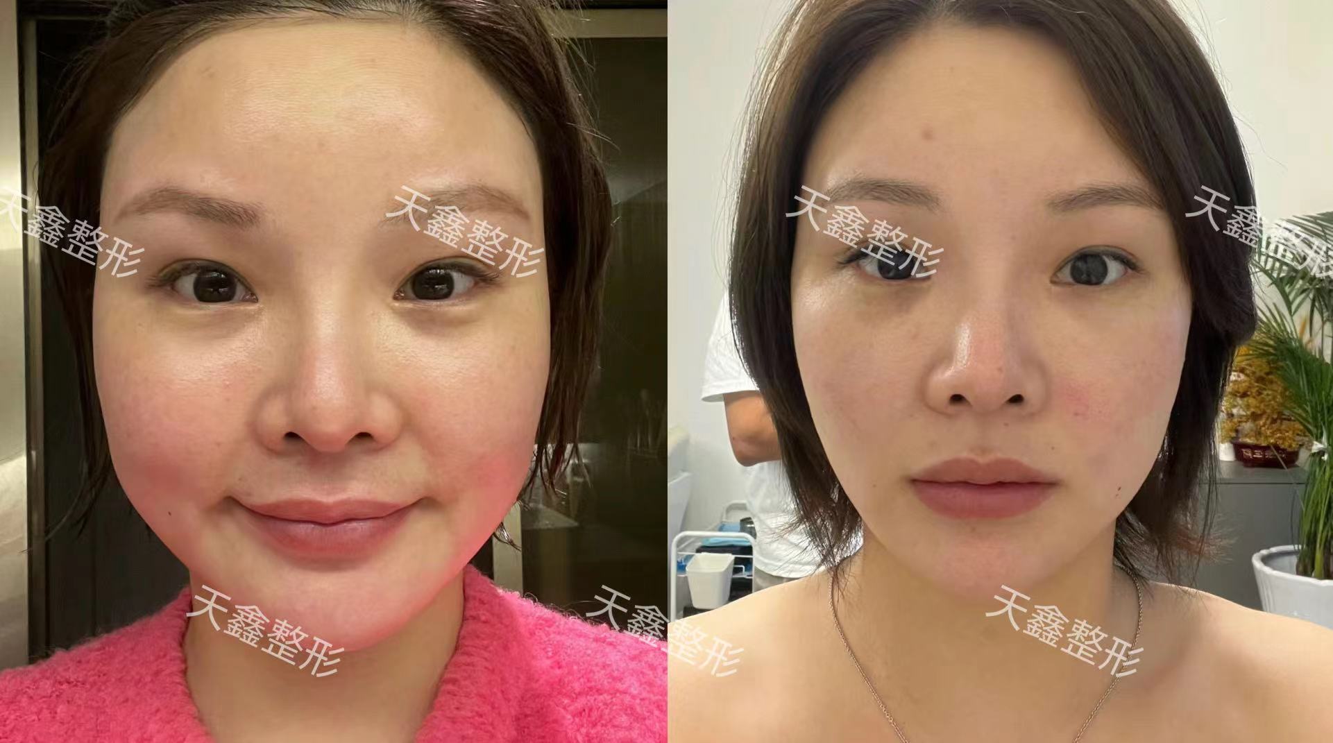 三、杭州好牙口腔醫(yī)院是正規(guī)醫(yī)院?jiǎn)帷技夹g(shù)顯實(shí)力