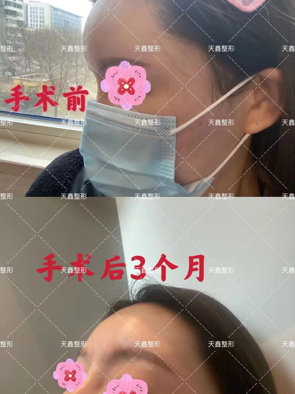 六、杭州好牙口腔醫(yī)院是正規(guī)醫(yī)院?jiǎn)帷颊咴u(píng)價(jià)見(jiàn)真章