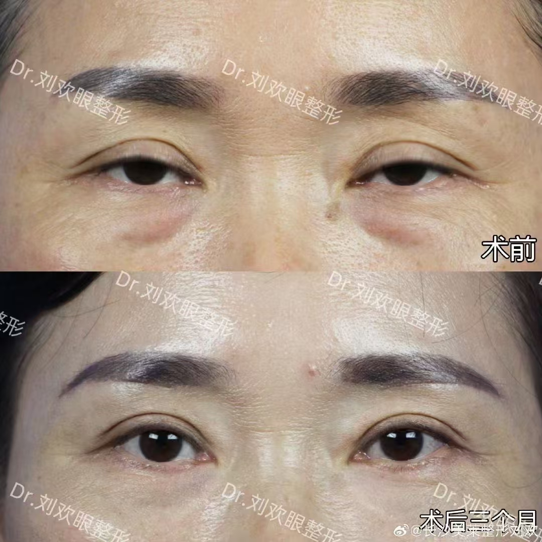 上海鄭小紅眼修復(fù)醫(yī)生：面診預(yù)約方式有哪些？