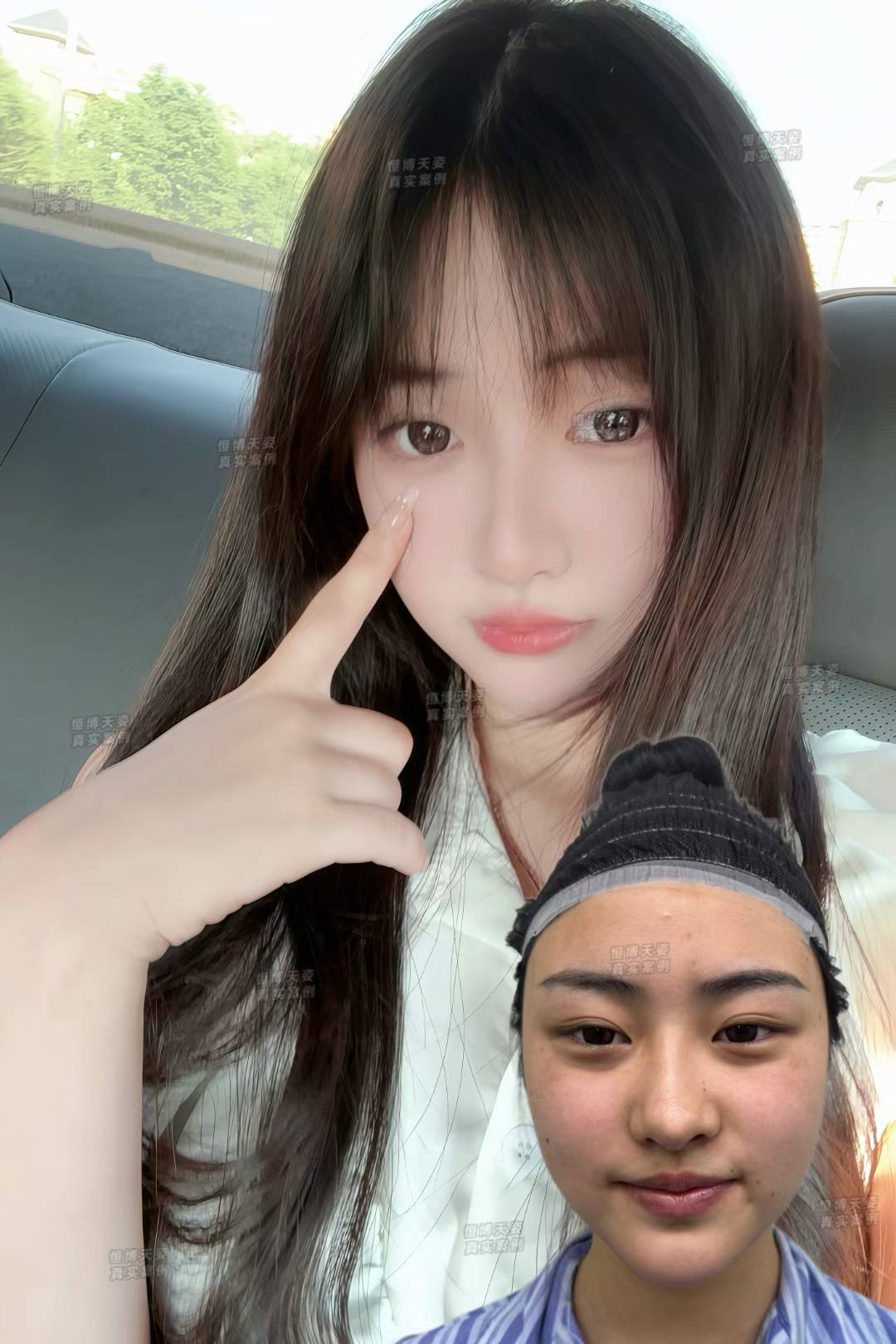 四、黄开亮修复鼻口碑怎么样？患者反馈一致好评，信任源于专精www.8682.cc