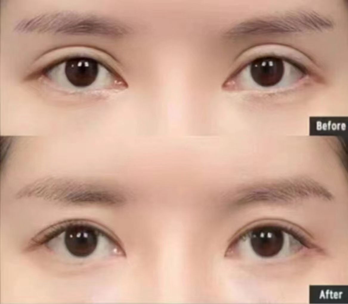 如何快速預(yù)約到上海鄭小紅醫(yī)生眼修復(fù)面診？