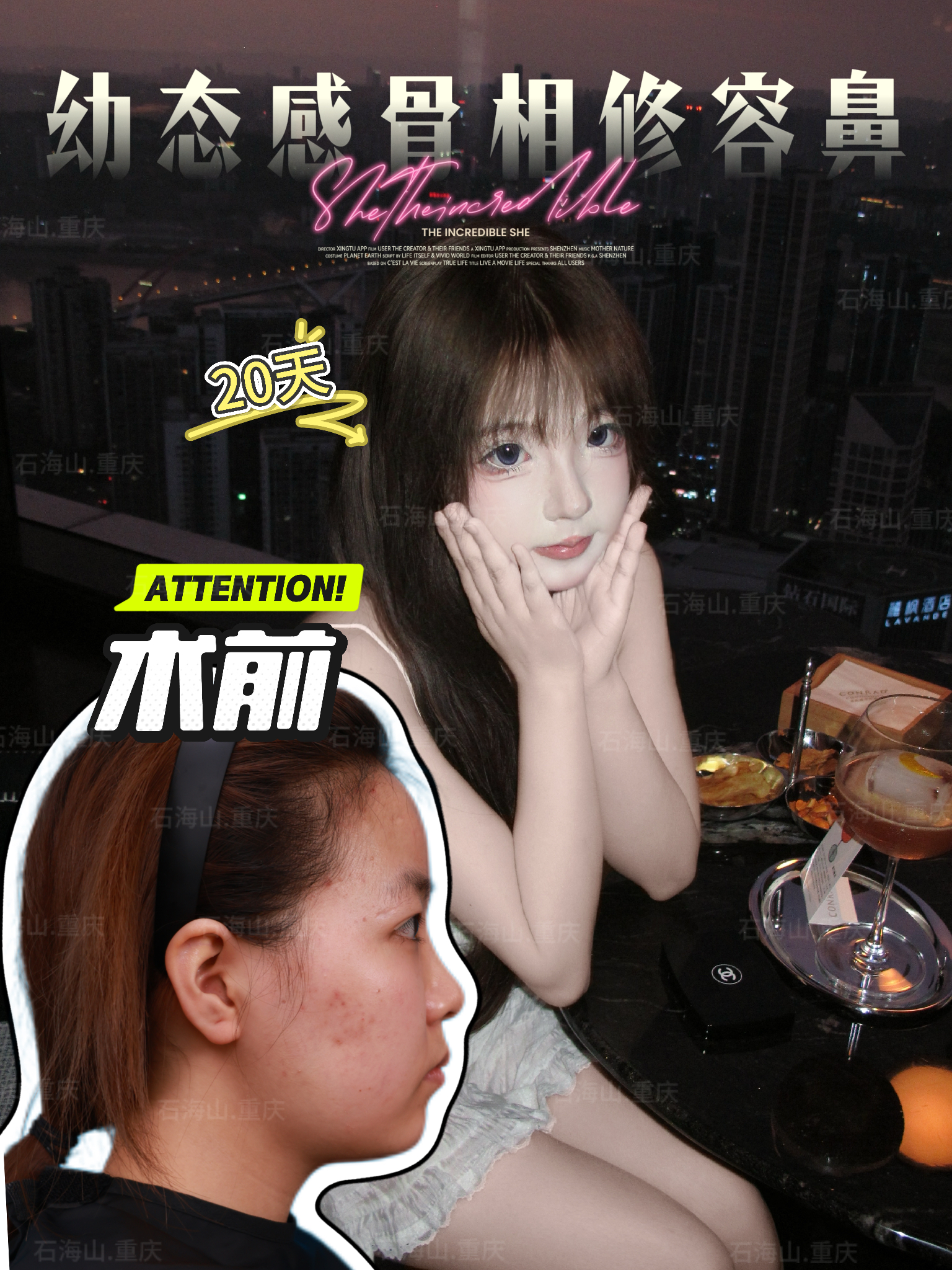 上海愛尚麗格做眼部修復(fù)找杜園園醫(yī)生挺靠譜——杜園園醫(yī)生的厲害之處