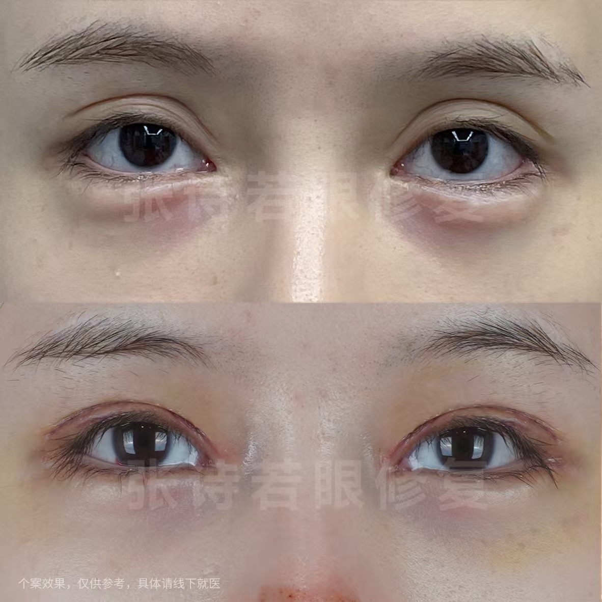 掛號(hào)緊張？提前了解鄭小紅醫(yī)生近期坐診時(shí)間表www.66ub.cn